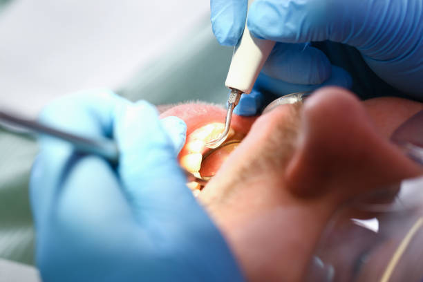 Best Emergency Dental Care for Sports Injuries in Midland, PA