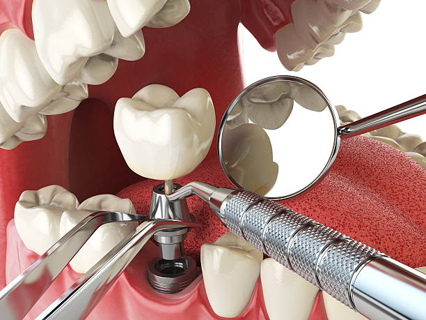Best Emergency Treatment for Oral Infections in Midland, PA